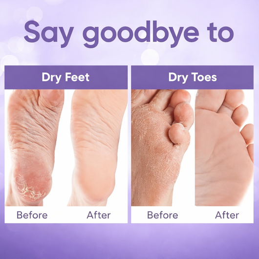 Foot Peel Mask for Baby Soft Skin
