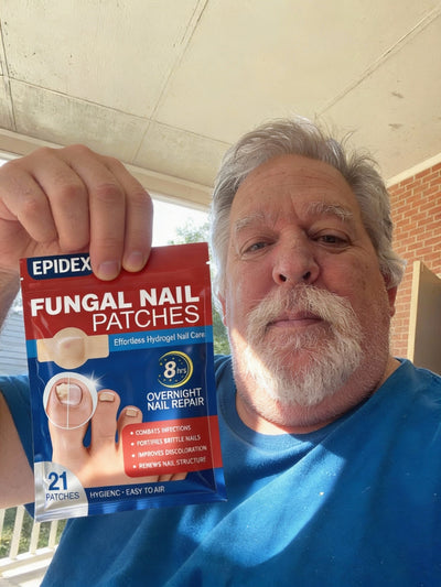 EPIDEX Fungal Nail Renewal Patches (3 Months)