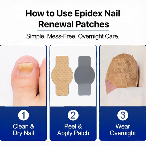 EPIDEX Fungal Nail Renewal Patches (3 Weeks)